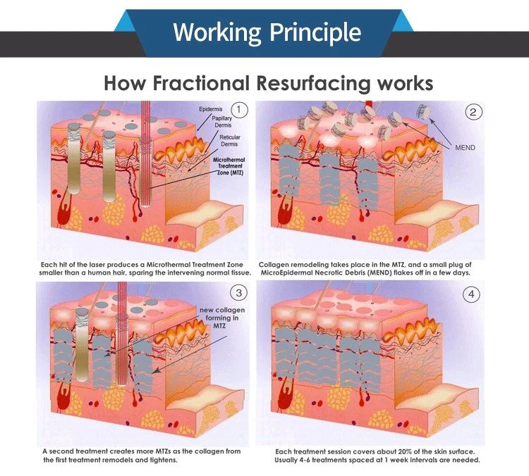 co2 fractional theory co2 fractional theory