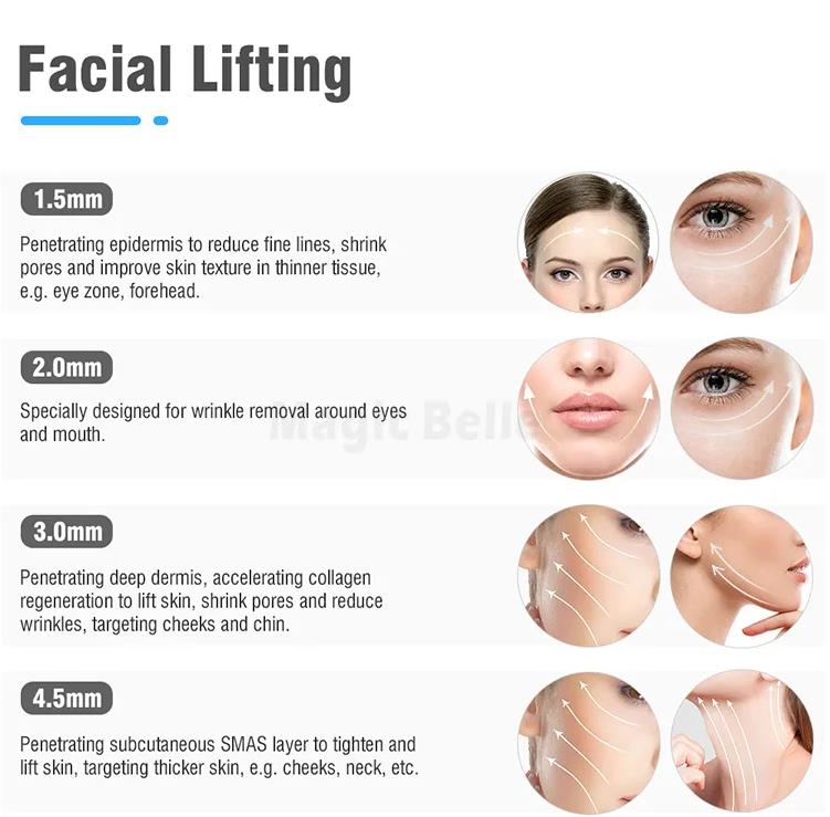 vertical 7d hifu