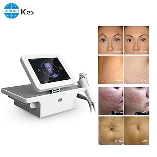 Rf Microneedle Rf Microneedling machin Salon Sèvi ak pòtab fraksyon RF Face Lifting Microneedle Equipo