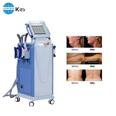 Cryolipolysis machin grès